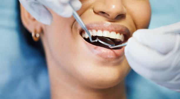 Best Emergency Dentist for Lost Fillings or Crowns in Meadowlakes, TX
