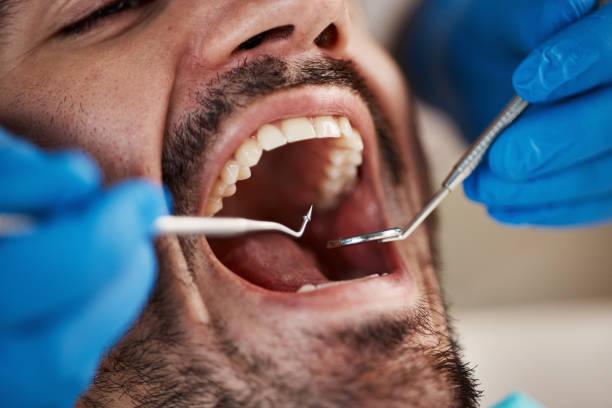 Best Mobile Emergency Dentist in Meadowlakes, TX