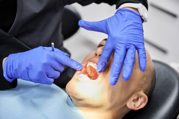 Best Emergency Dental Services for Seniors in Meadowlakes, TX